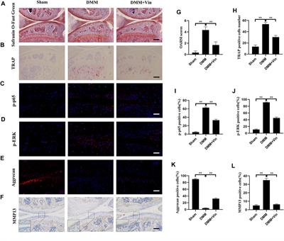 <mark class="highlighted">Vin</mark>doline Attenuates Osteoarthritis Progression Through Suppressing the NF-κB and ERK Pathways in Both Chondrocytes and Subchondral Osteoclasts